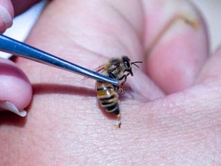 Apiterapia: que es, indicaciones de uso.